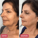 CollageSkin – Mascarilla antiedad con efecto lifting