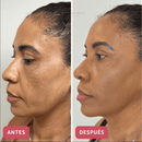 CollageSkin – Mascarilla antiedad con efecto lifting