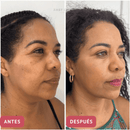 CollageSkin – Mascarilla antiedad con efecto lifting